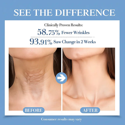 Collagen Peptide Anti-Wrinkle Neck Mask